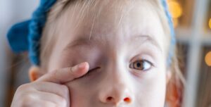 Tired young girl rubbing her eyes, concept of childhood allergies, eye irritation, and pediatric vision health.